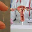6 foods that may help support healthy cervical mucus
