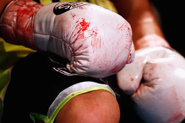 Boxing banned in Ghana after deaths of two boxers in seven months