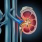 What causes kidney stones? 7 risk factors you should know