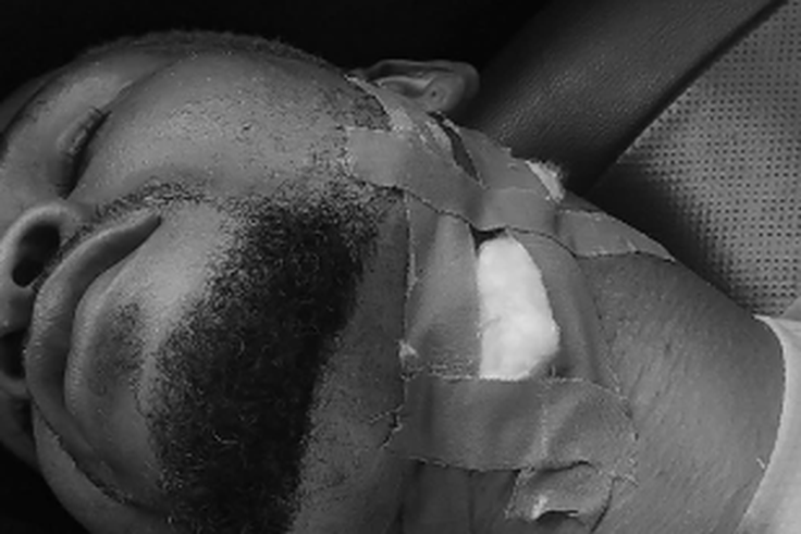 Nigeria Football Chaos: Fan stabbed player after NFL clash