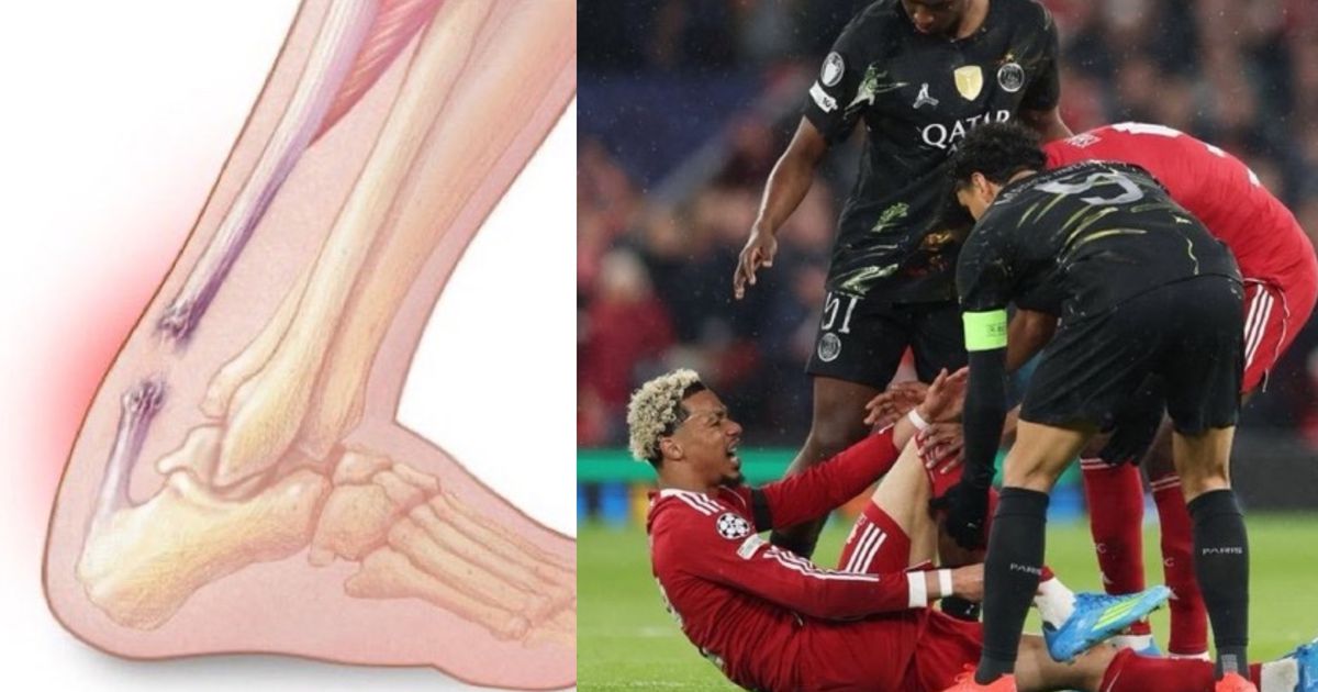 Ekitike to miss 2026 World Cup after rapturing Achilles during PSG clash