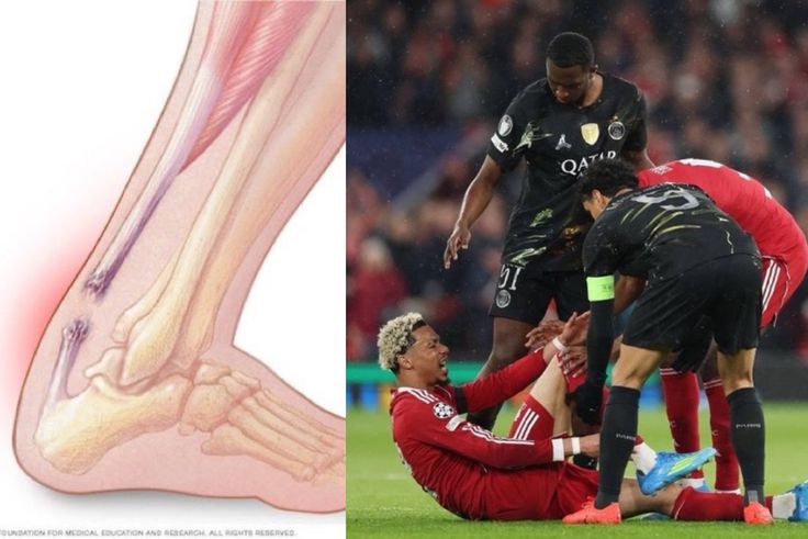 Ekitike to miss 2026 World Cup after rapturing Achilles during PSG clash