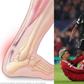 Ekitike to miss 2026 World Cup after rapturing Achilles during PSG clash
