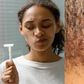 Ghanaian dermatologist warns against shaving too close to the skin- Here's why