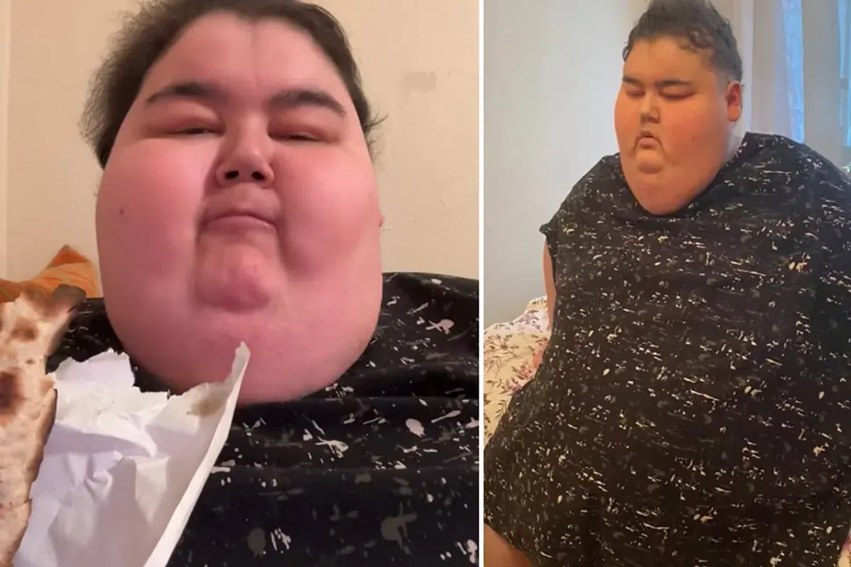 24-year-old lady dies from obesity