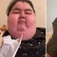 24-year-old lady dies from obesity