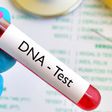 Is DNA always about trust? Here’s why you should conduct a DNA test after childbirth