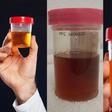 Is your pee normal? The 3 colours you shouldn't ignore