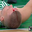 Basketball star suffers serious head injury as blood gushes out from forehead (Video)
