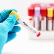 Ghana closes type 2 Polio outbreak as it marks World Polio Day 2026