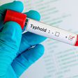 4 stages of typhoid fever: Symptoms and progression explained