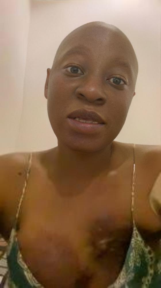 Cynthia Anijekwu on her cancer diagnosis
