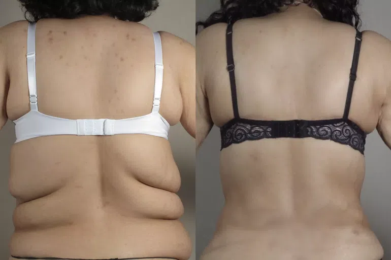 strange-cosmetic-surgery