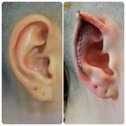 weird-cosmetic-surgeries