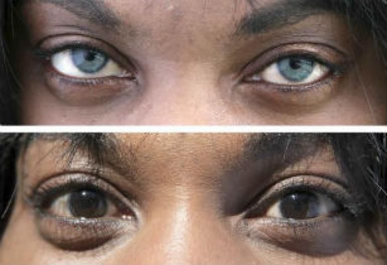 strange-cosmetic-surgery