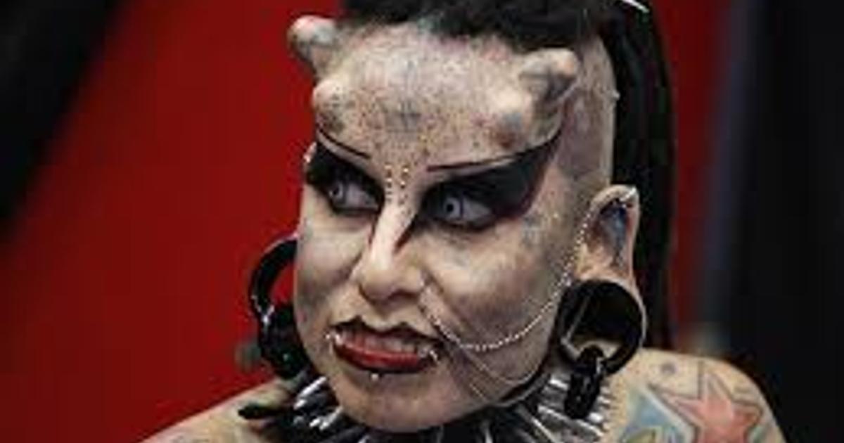 Top 9 Strangest Plastic Surgeries in 2026: From Eye Color to Palm Lines