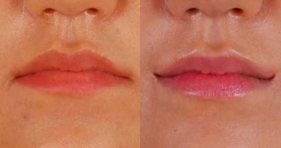 strange-cosmetic-surgeries