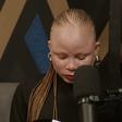 She was told she was the best candidate, but her albinism stood in the way of the job she deserved