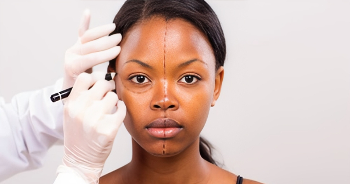 BBL (Brazilian Butt Lift) and 4 Other Cosmetic Surgeries That Can Cost You Your Life