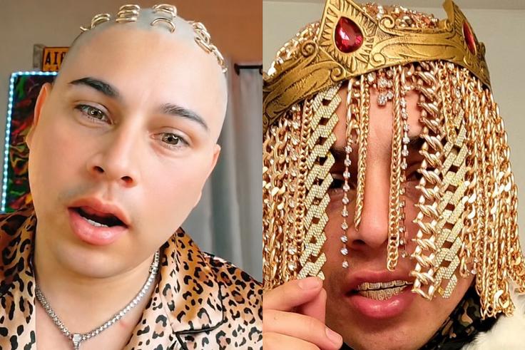 Meet Dan Sur, the rapper who traded his natural hair for gold chain implants at 23