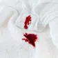How to easily remove period blood stains from sheets
