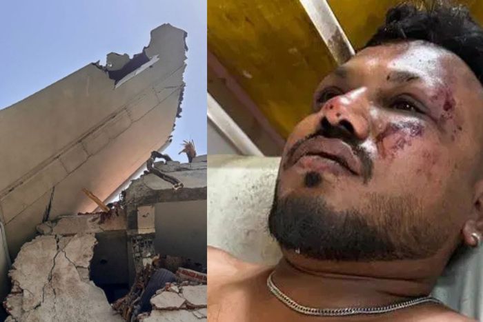 Vishwash Kumar Ramesh, the only confirmed survivor of the Air Indian crash