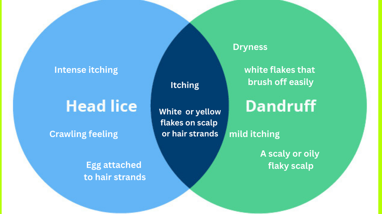 difference-between-dandruff-and-lice