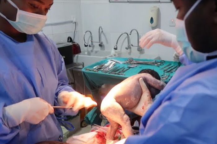 FG offers free CS to Nigerians to reduce maternal and newborn mortality