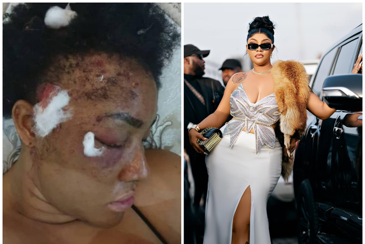 'Attempted Assassination': Angela Okorie reveals bullet fragments still in her head