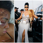 'Attempted Assassination': Angela Okorie reveals bullet fragments still in her head