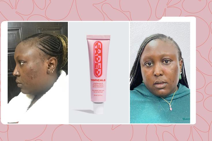 Why I’m Adding Topicals Faded to My Skincare Routine After A Month