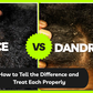 Lice vs Dandruff: How to Tell the Difference and Treat Each Properly