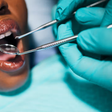 Why the teeth can feel different after scaling