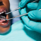 Why the teeth can feel different after scaling