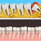 Teething isn’t just for babies: why wisdom teeth can cause trouble in your twenties