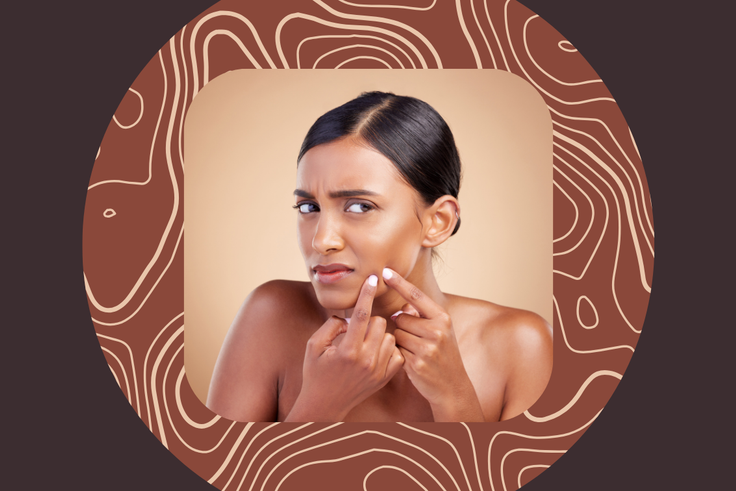 Zap Pimples Fast With These 7 Acne Spot Treatments That Actually Work
