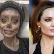 5 people who took plastic surgery a little too far