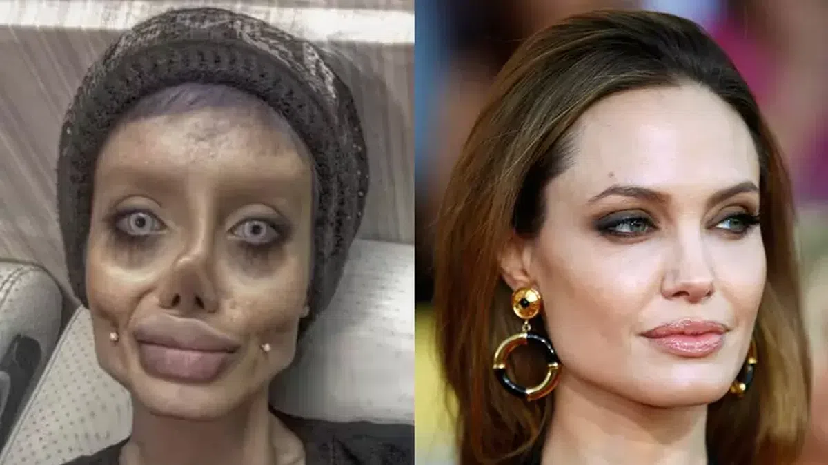 People who took plastic surgery a little too far | Pulse Nigeria