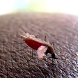 Why mosquitoes bite some people more than others, scientists finally have answers