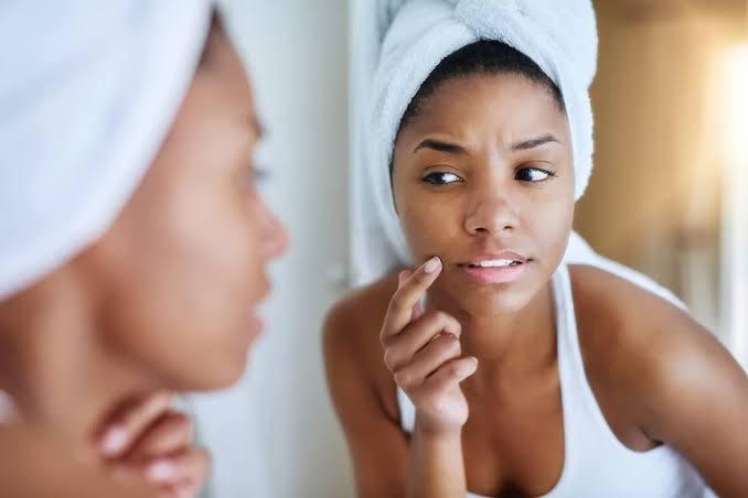 People who produce more sebum may be more likely to produce these attractive compounds.