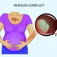 The RH Factor: How it can affect your pregnancy