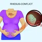 The RH Factor: How it can affect your pregnancy