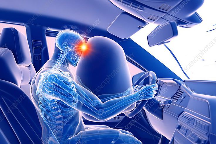 If your car has airbags, avoid these 4 deadly mistakes