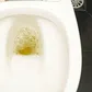 Why is my urine foamy?