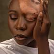 ‘He said he wasn't feeling the vibe again’ — Nigerian lady says boyfriend dumped her after vitiligo diagnosis