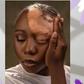 Video: ‘He said he wasn't feeling the vibe again’ — Nigerian lady says boyfriend dumped her after vitiligo diagnosis