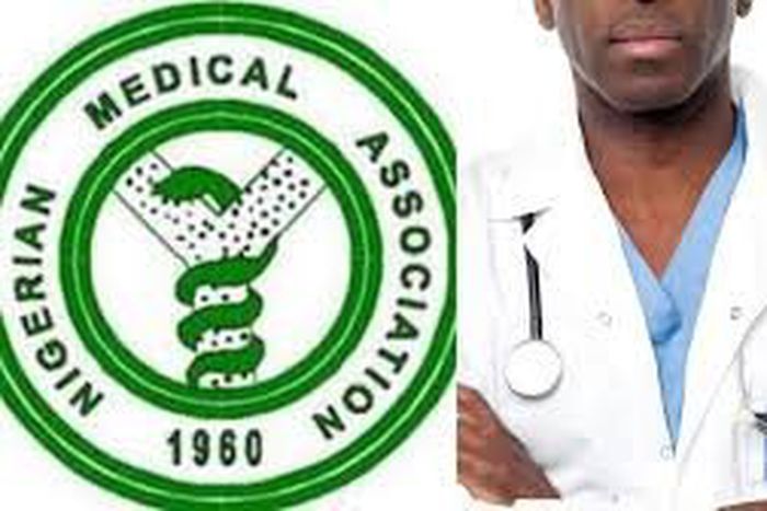 NMA gives FG tips on how to stop Japa  Syndrome in health sector