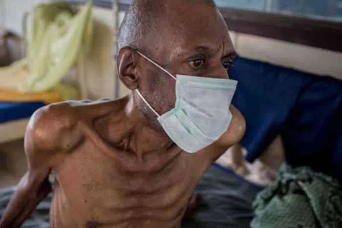 Indwara 6 zica abantu ku isi! harimo ica intege abagabo ntibagire ubushake bwo kurongora