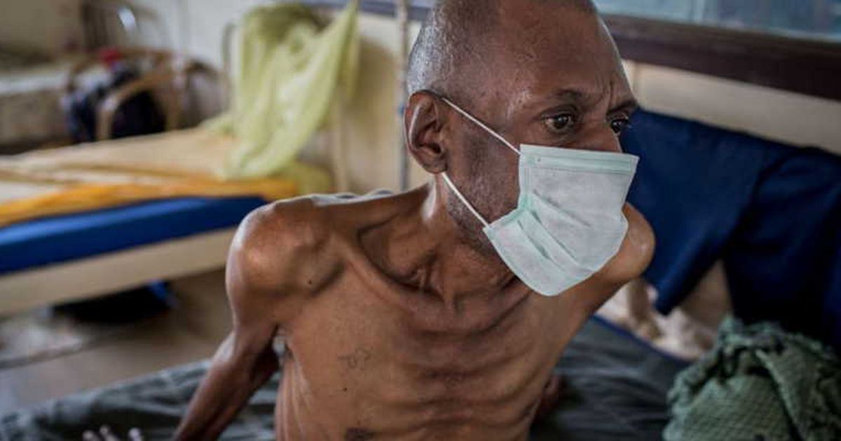 These 6 diseases claim more lives annually than HIV, according to WHO data