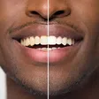 5 foods that can naturally whiten your teeth